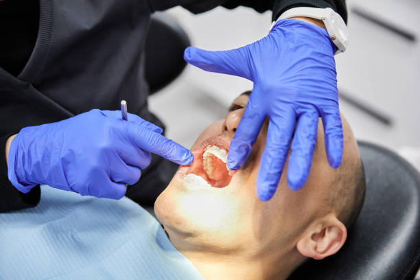Best Dental Abscess Treatment in USA